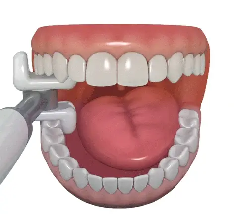 Water Flosser That Cleans All Teeth in 10 Seconds