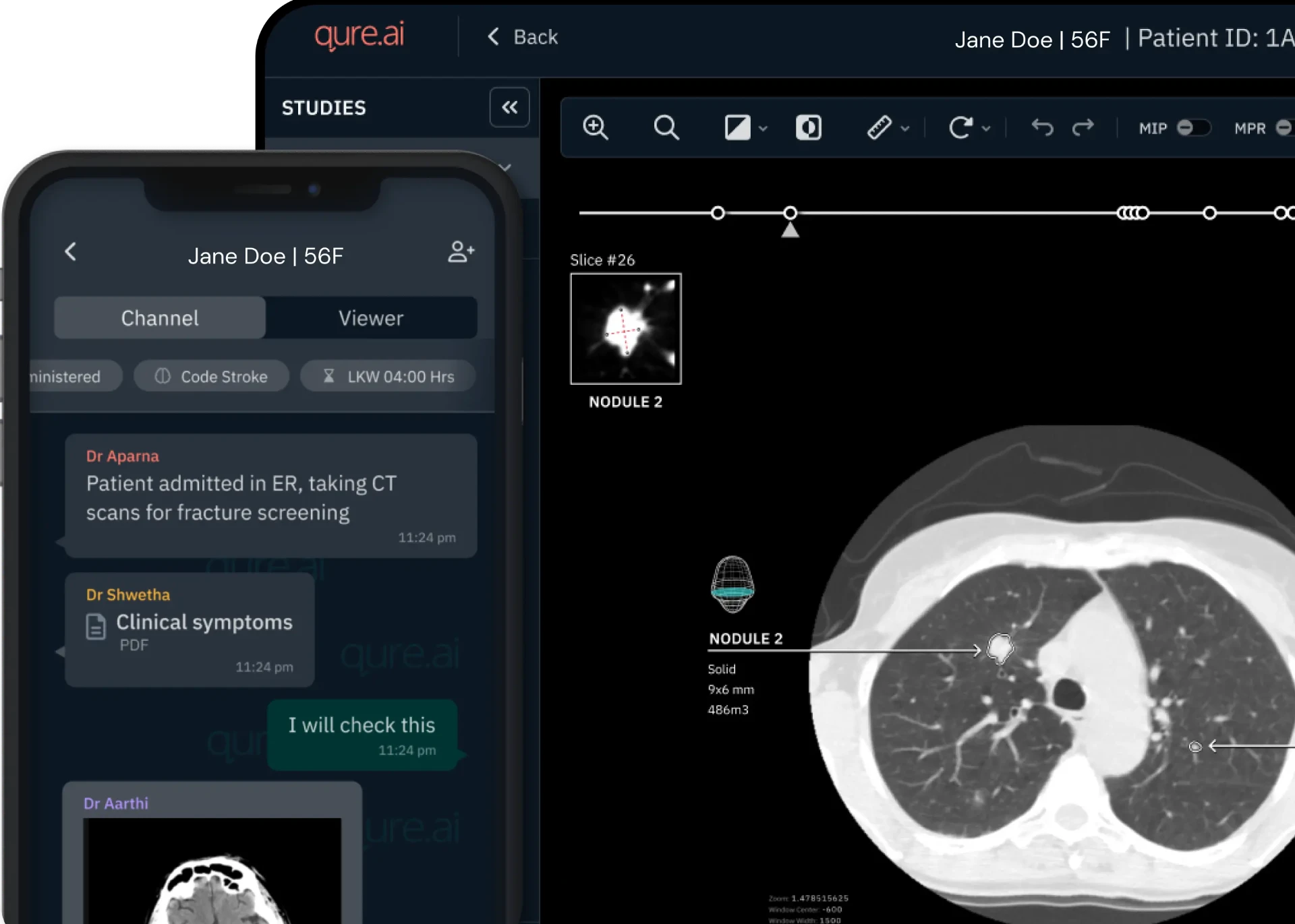 Qure.ai’s 2025 Breakthrough in AI Diagnostics