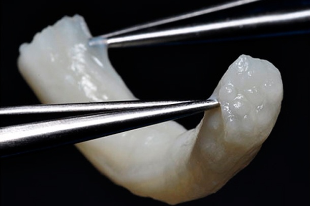 Avance Repairs Peripheral Nerves Biologically