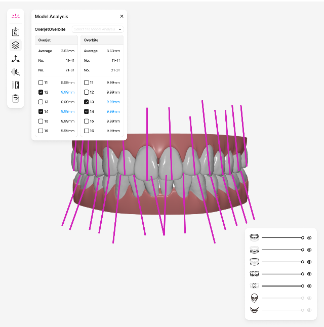 AI Now Plans Your Teeth Straightening in Minutes